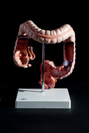 Cover image for Intestinal diseases